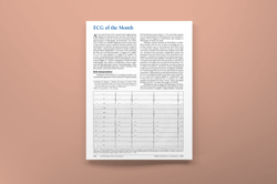 ECG of the Month_Atrial Flutter_thumb-min
